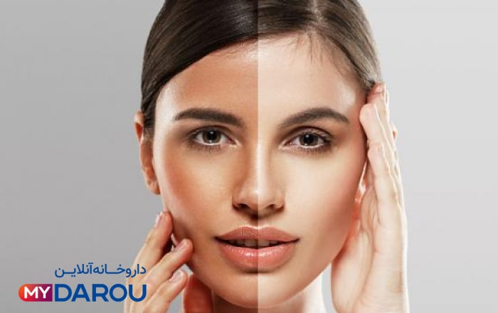 مای دارو - پر فروش ترین کرم روشن کننده پوست 