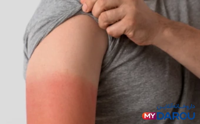 مای دارو - بهترین ضد آفتاب|ضد آفتاب ضد لک چی خوبه؟