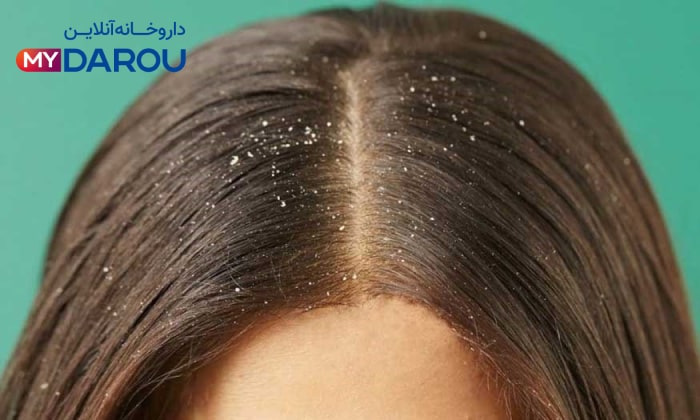 مای دارو - بهترین شامپو ضد شوره مردانه و زنانه